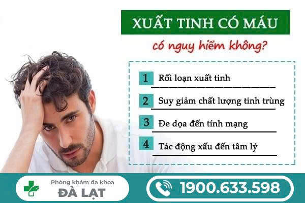 Hình ảnh minh họa